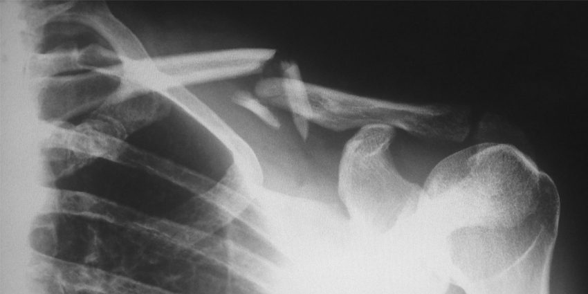 Can Surgeon Ultrasounds Be as Accurate as a Radiologist’s?