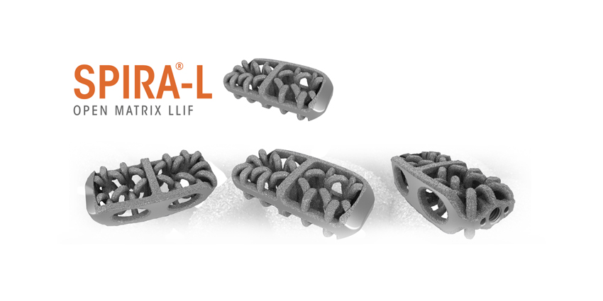 Patent Issued for Camber Spine’s SPIRA Lateral 3.0