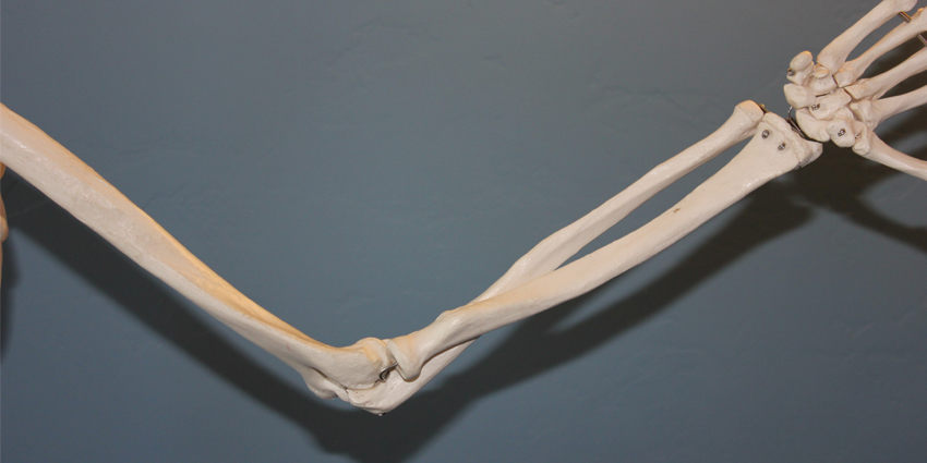 Instability Possible With Refractory Lateral Epicondylitis