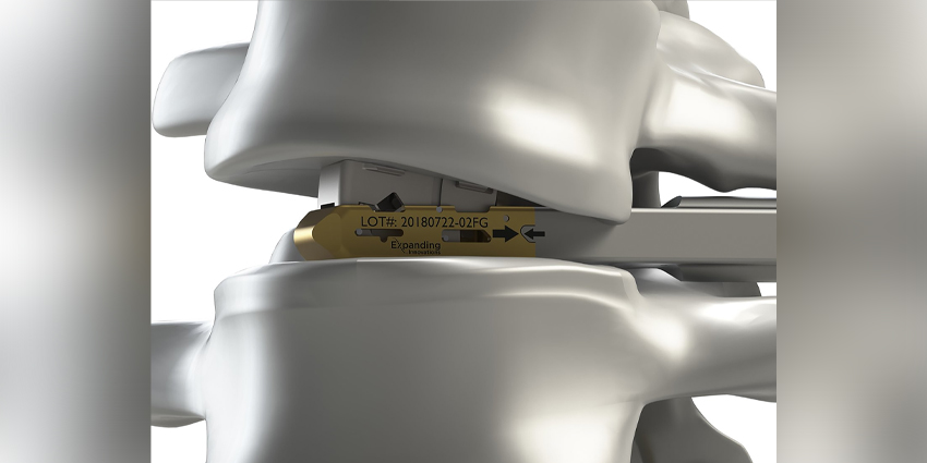 DePuy Synthes, Expanding Innovations Sign Distribution Agreement