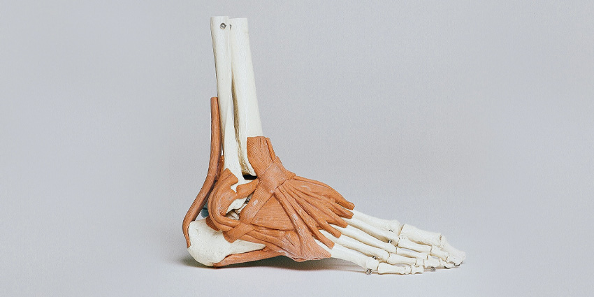 Functional vs Mechanical Instability Using MRI