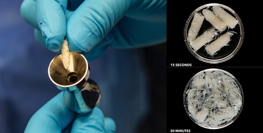 First-in-Man for Novel TLIF Bone Fiber Graft