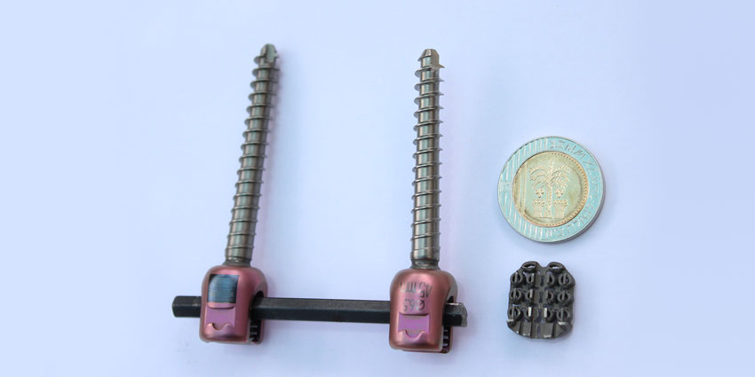 Screwless Spine Fusion Implant Focus of New Study