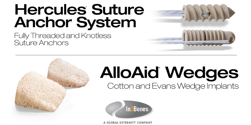 In2Bones Global Launches Hercules Suture Anchor System
