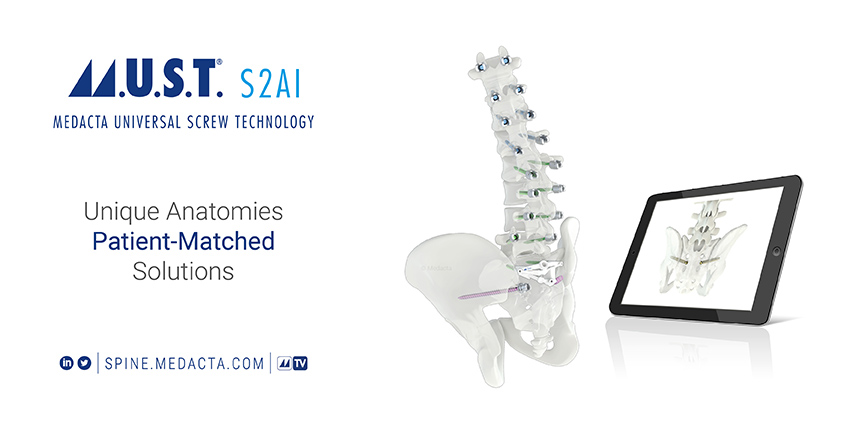 Medacta Launches MySpine for S2-Alar-Iliac Fixation