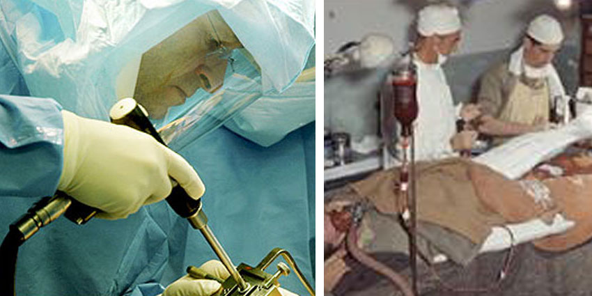 History of Modern Spine Surgery: The CRI Story — Part I