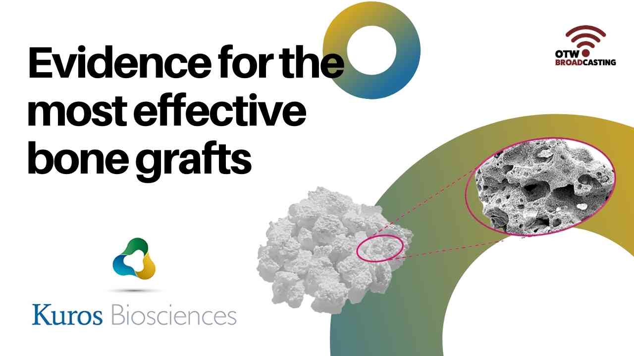 Evidence for the Most Effective Bone Grafts