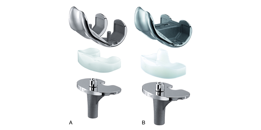 Massive TKA Study: Increased Revision Risk With PS Bearings
