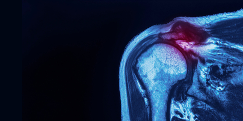 Repair Tension vs Microvascular Blood Flow: Where’s the Line?