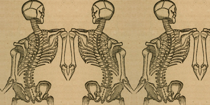Taking Another, Deeper Look at Vertebral Body Tethering