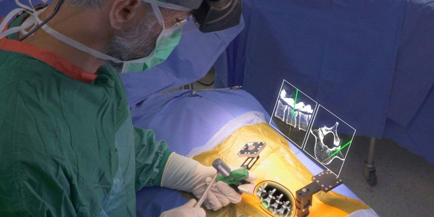 How Fast or Accurate Is Screw Placement Using Augmented Reality?