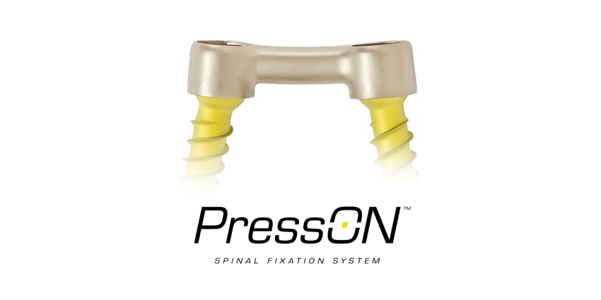 Truly Novel Posterior Lumbar Fixation System Launched