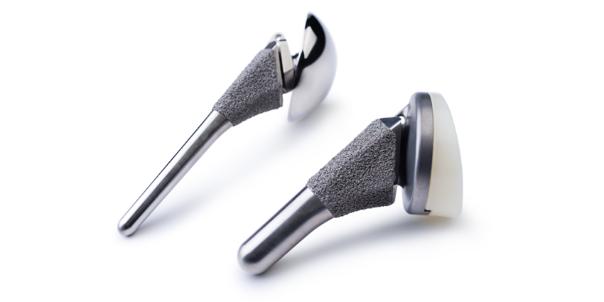 FDA 510(k) Clears Personalized Shoulder Replacement