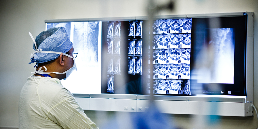 How Well Can Segmental Lordosis Predict Outcomes?