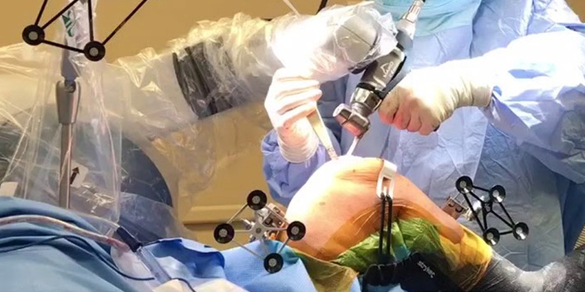 Want Better TKA Patient Outcomes? Call in the Robots. Here’s Why.