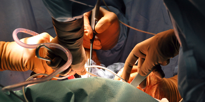 Reducing TKA Re-Revision Rates