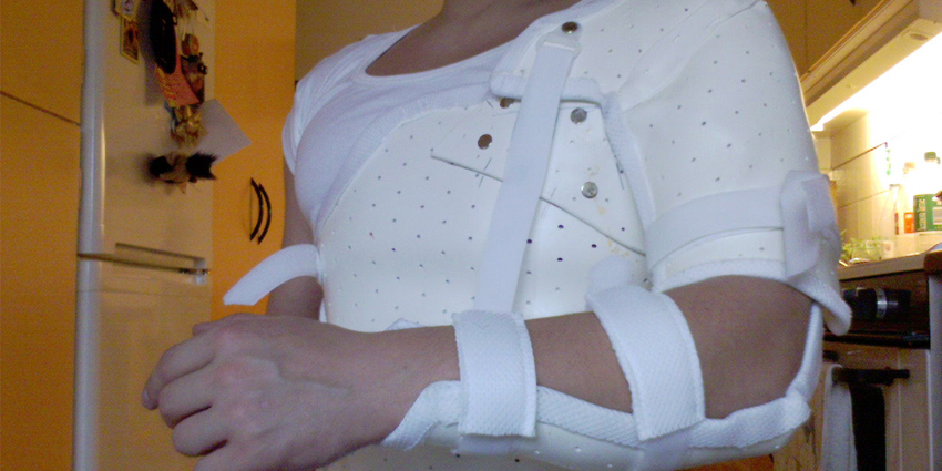 What Are the Risk Factors for Shoulder, Elbow Surgery?