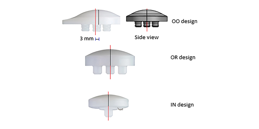 To Resurface the Patellar: Onlay, Inlay or Onlay Oval?