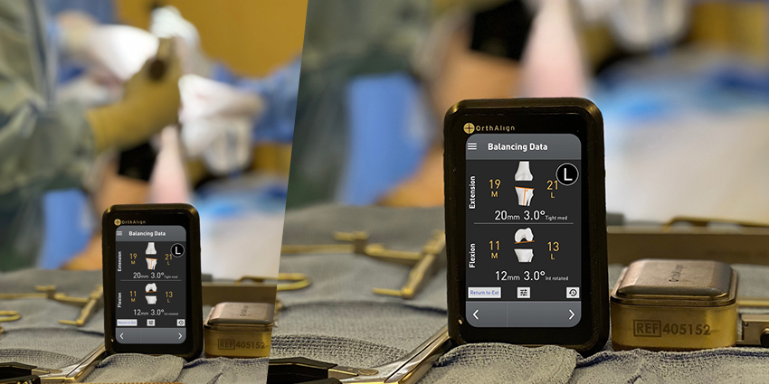 OrthAlign Releases New Personalized Alignment Lantern® App