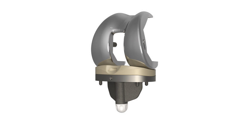 FDA Clears TKA System With Novel UHMWPE Crosslinked Surface