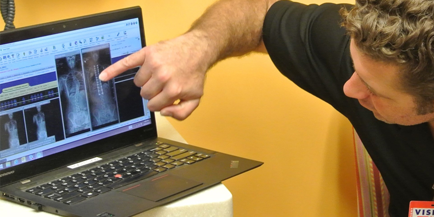 Vertebral Body Tethering Struggles in Multicenter Study