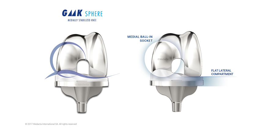 New Knee Study Reaches Counter-Intuitive Outcome