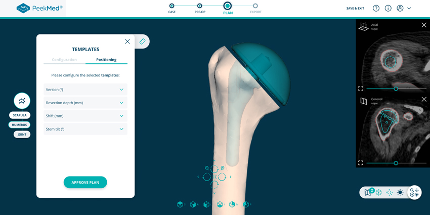 510(k) Clearance for Web-Based Orthopedic Planning Solution