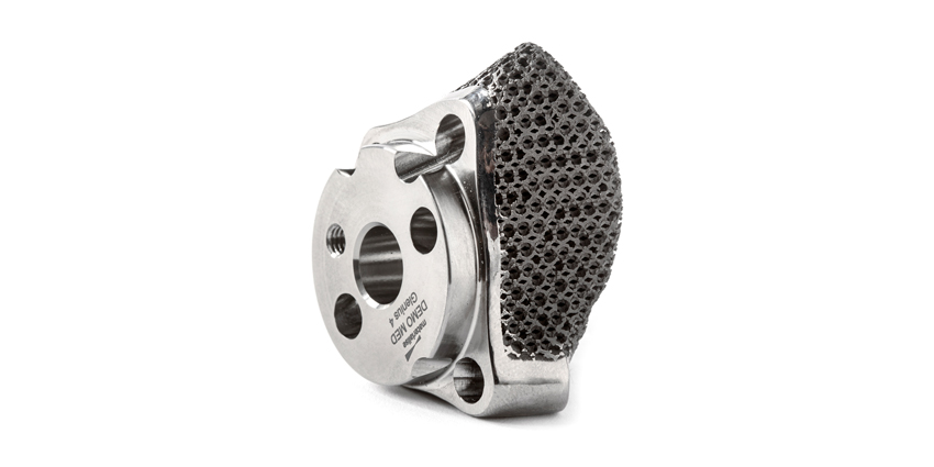 Personalized Shoulder Implant Added to Exactech Portfolio