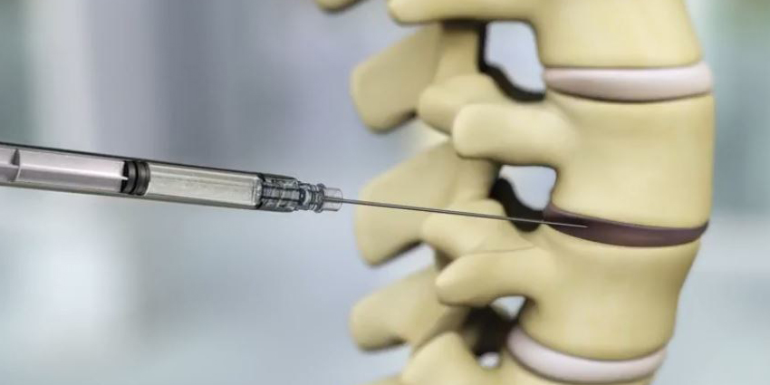 New Evidence Supports Viable Cell Spine Treatment