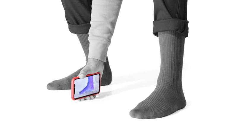 3D/AI Smart Phone Foot Scans: Ortho in Your Pocket?