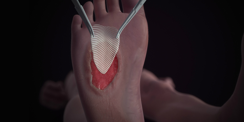 LifeNet Health Takes Over Bioventus Wound Care Business