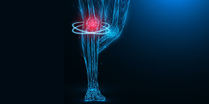 Could Inflammatory Arthritis Falsely Indicate Joint Infection?