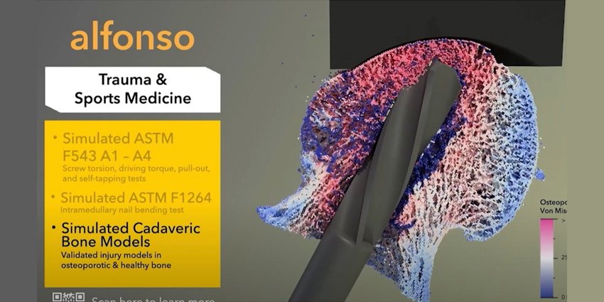 Ultra-Realistic Implant Simulation Testing Launches