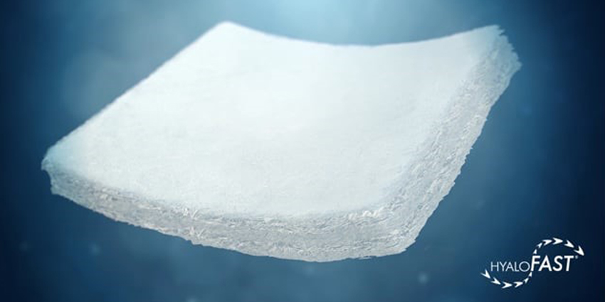 FDA Approval Nears for Anika’s Cartilage Repair Product