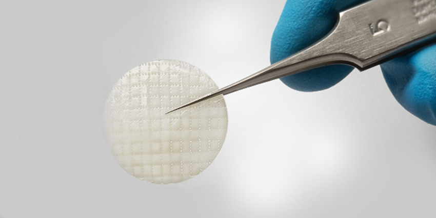 3-Year Follow-Up Positive for Living Chondrocyte Cartilage Repair
