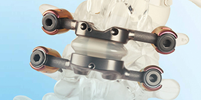 FDA Approves TOPS for Spondylolisthesis and Stenosis