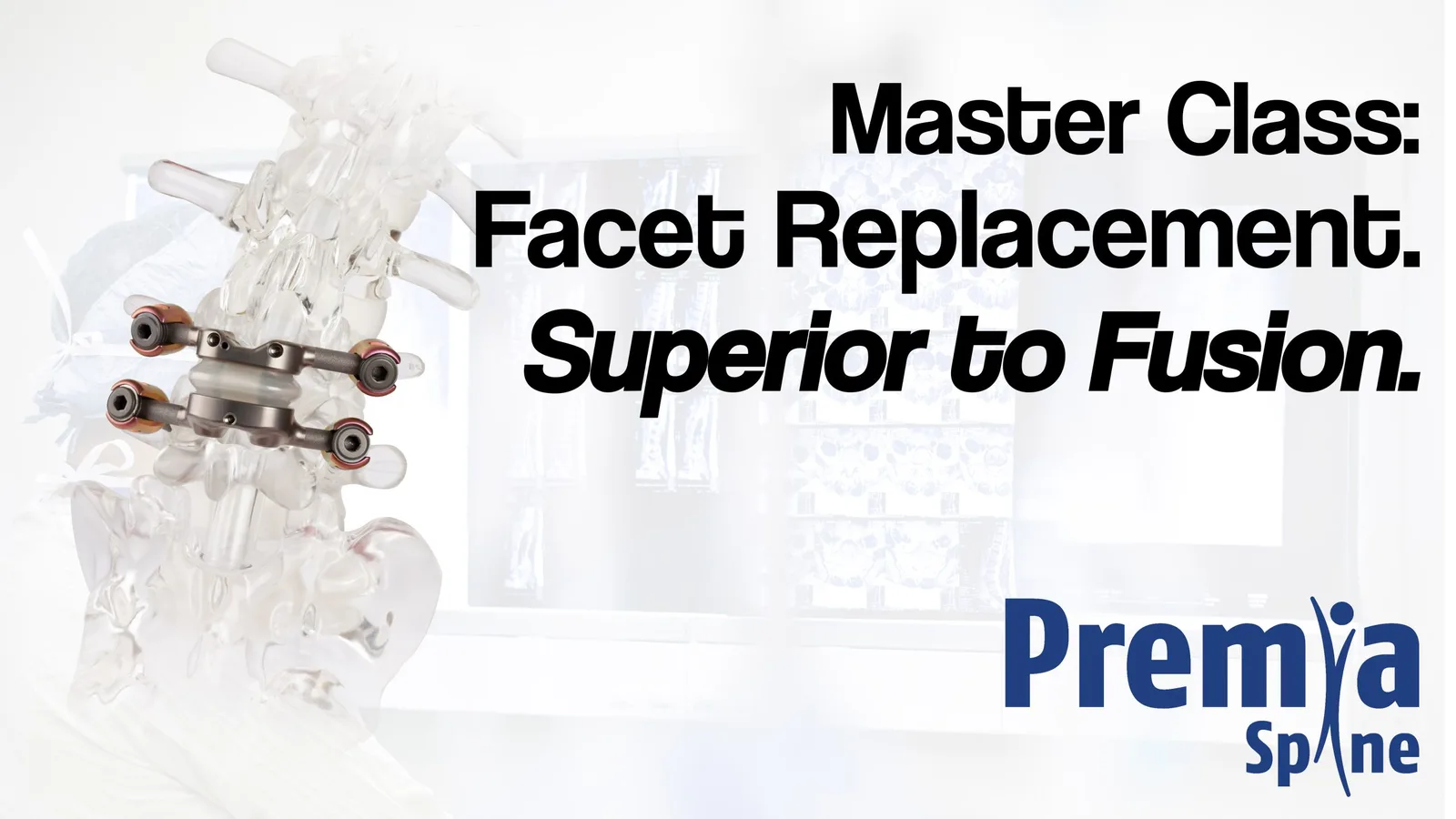 Facet Replacement. Superior to Fusion