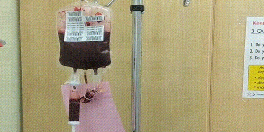 New Algorithm 97% Predictive for Post-Op Anemia Risk