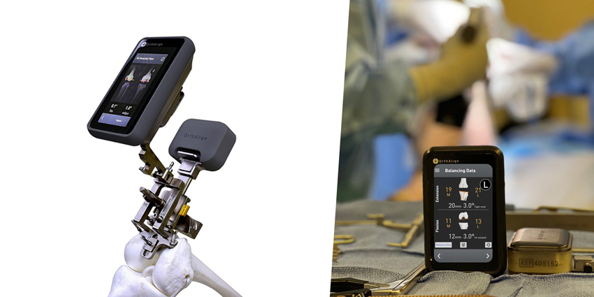 OrthAlign’s Handheld NAV System Hits 300,000 Case Milestone