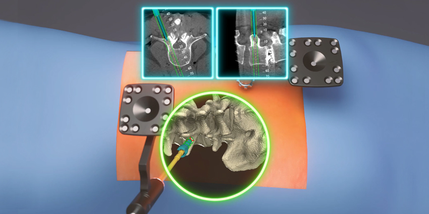 Augmedics Raises $82.5M