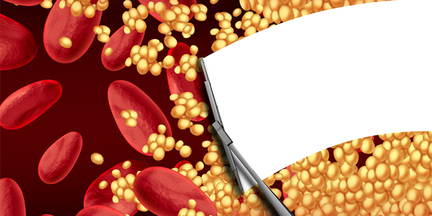 New Guidelines for Anti-Coagulation Management Issued