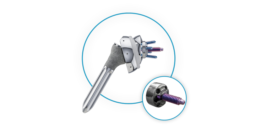 New Shoulder System Features Smallest Baseplate Yet