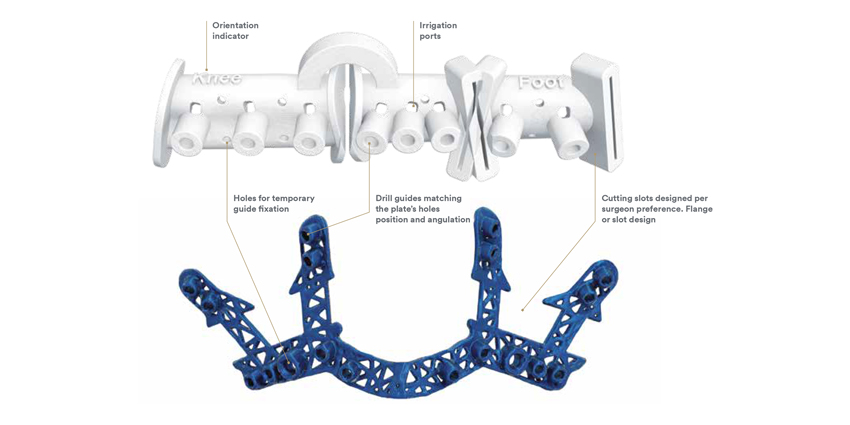 FDA’s Draft Guidance for Patient-Matched Ortho Implant Guides