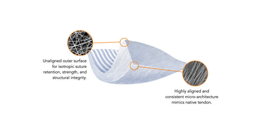 LifeNet Health Sues Zimmer Biomet & Embody for Patent Infringement