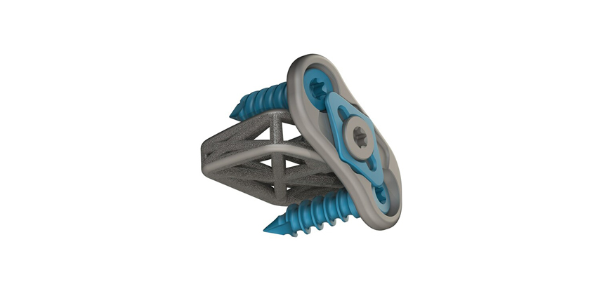 FDA Clears Novel, 3D Printed Integrated Cervical Plate