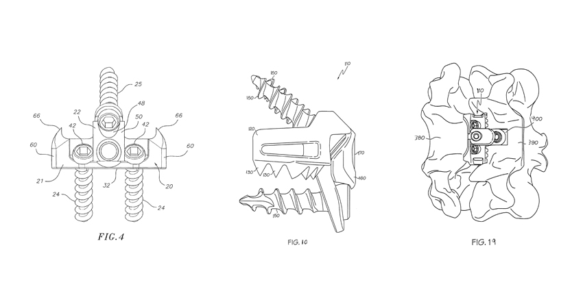 RSB Spine Sues Orthofix and SeaSpine for Patent Infringement