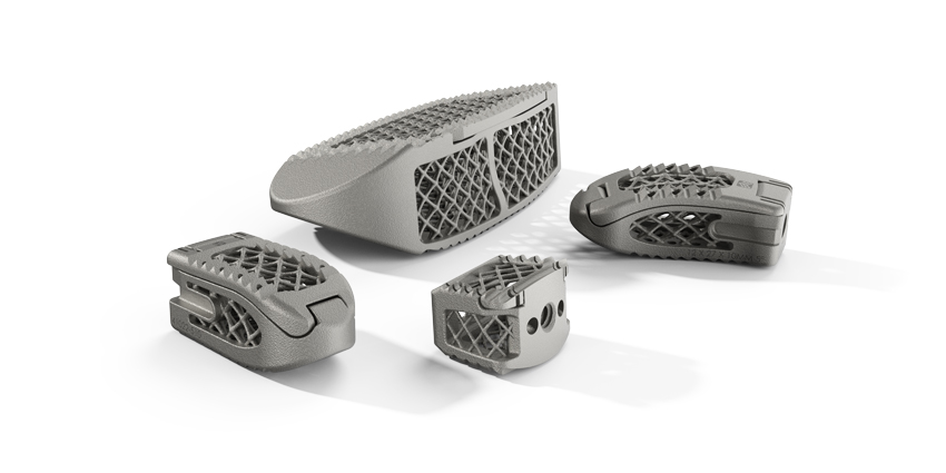 ‘Ventana’ – An Interbody Implant With a Lid Launches