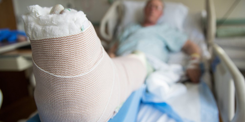 How Much Skeletal Mass Is Lost After a Fragility Fracture?