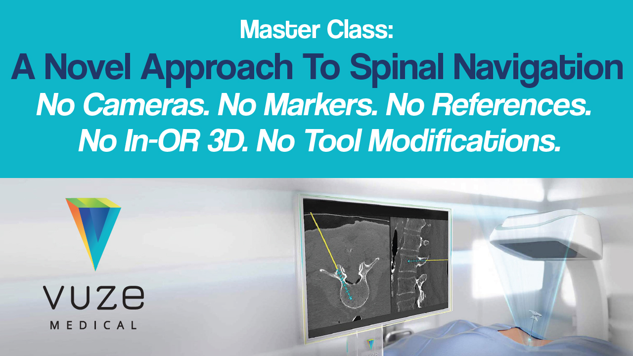 A Novel Approach to Spinal Navigation