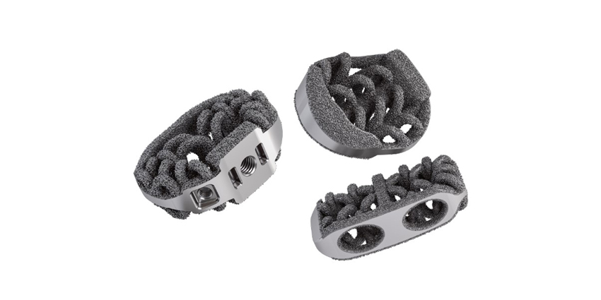 Structure vs Chemistry in 3D Printed Spinal Implants